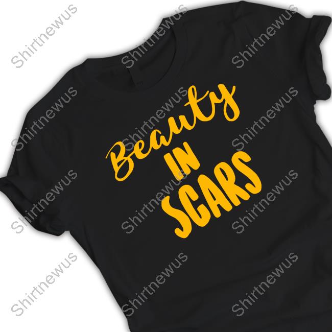 Official Kechi Okwuchi Beauty In Scars Shirt